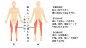 坐骨神経痛　ウォーキング