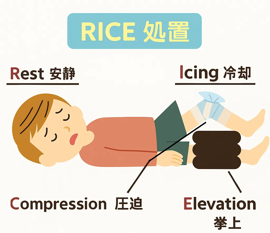 肩鎖関節亜脱臼 テーピング
