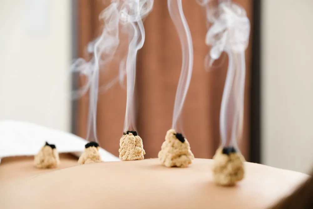 首痛 お灸