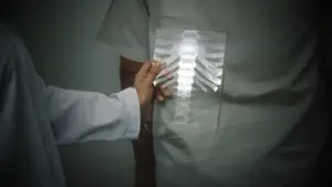 椎間板ヘルニア　軽度