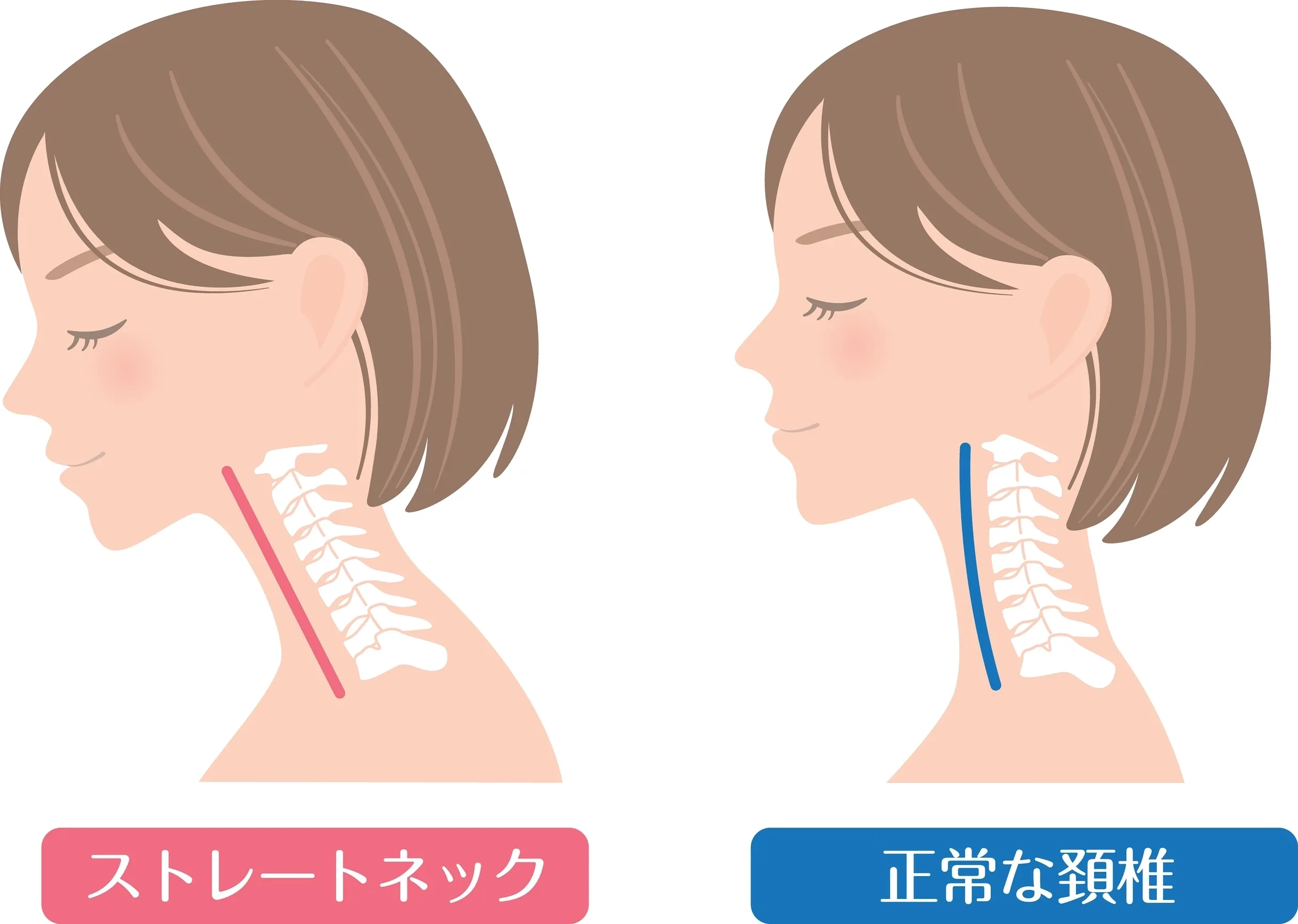 腰痛 首痛 ストレッチ
